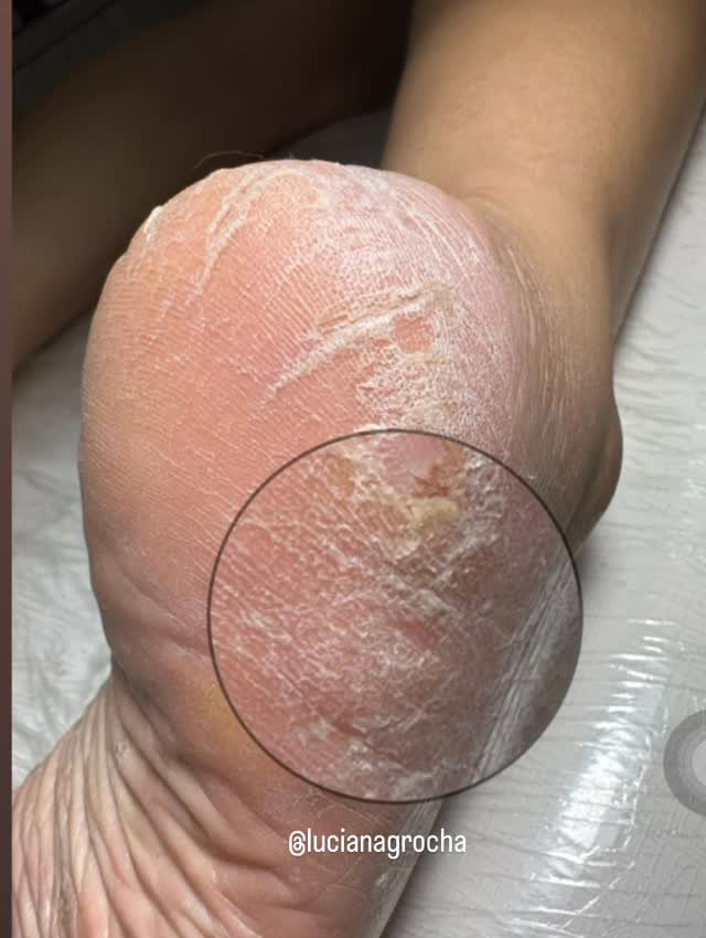 lucianagrocha 게시물 이미지: Avaliação é muito importante na Renovação &...