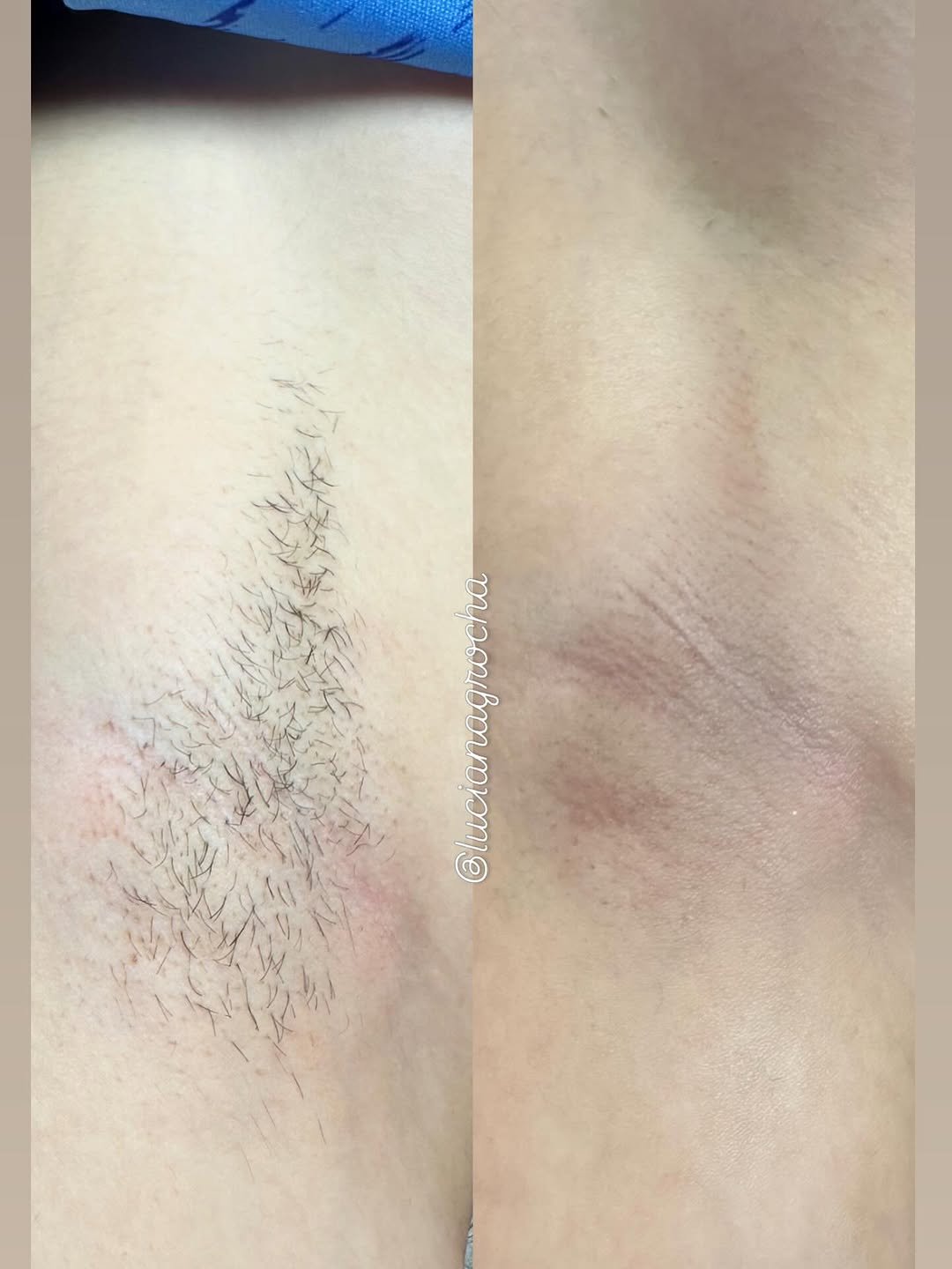 Photo by Luciana Rocha | Estética dos Pés / D’Epilação & Sobrancelhas in Studio Luciana Rocha with @luciana.grocha. May be an image of text.