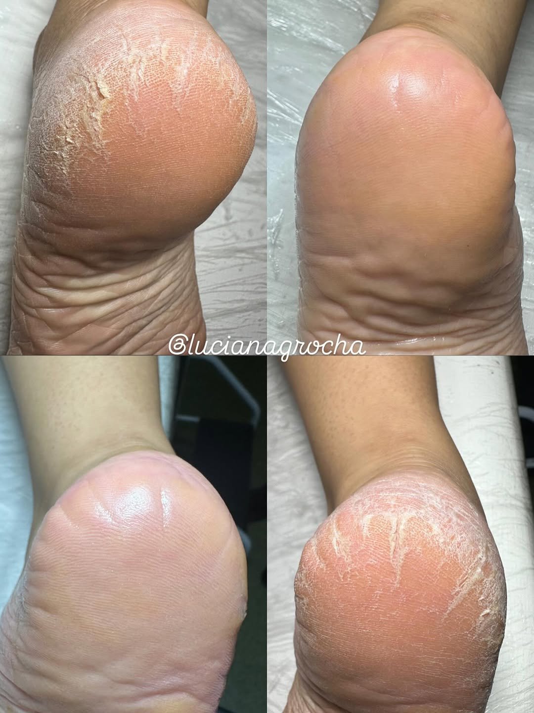Photo by Luciana Rocha | Estética dos Pés / D’Epilação & Sobrancelhas in Cajàzeiras, Paraiba, Brazil. May be an image of text.
