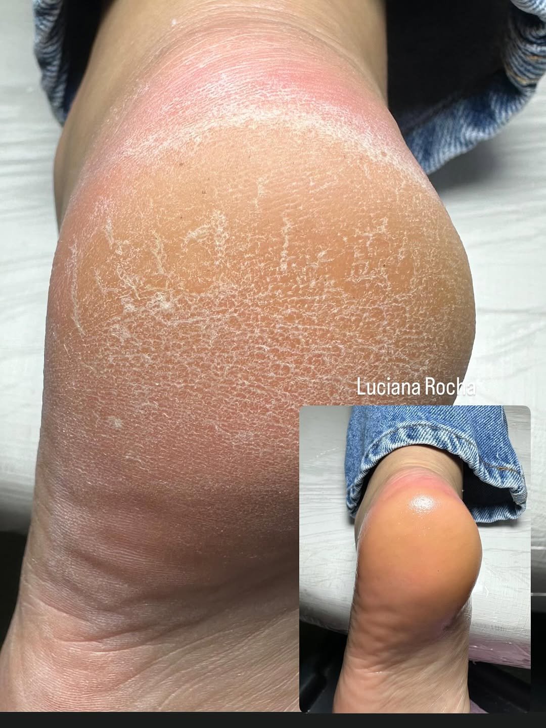 Photo by Luciana Rocha | Estética dos Pés / D’Epilação & Sobrancelhas in Studio Luciana Rocha. May be an image of text that says 'Luciana Roch LucianaRocha a ww'.