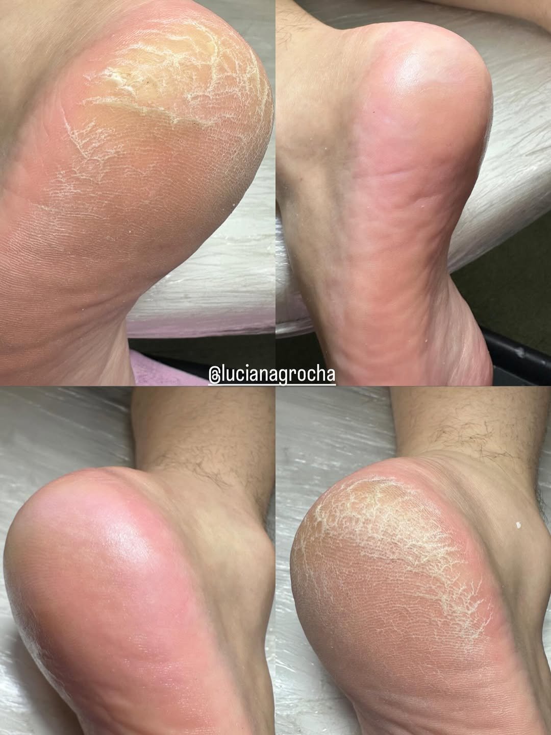 Photo by Luciana Rocha | Estética dos Pés / D’Epilação & Sobrancelhas in Studio Luciana Rocha with @luciana.grocha. May be an image of one or more people, fingernails and text.