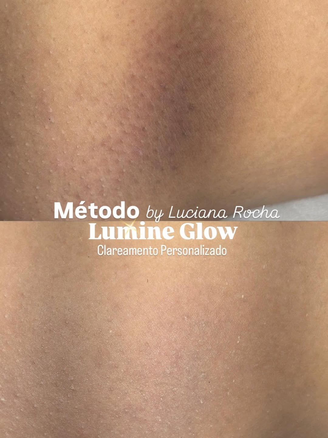 Photo by Luciana Rocha / D’Epilação / Sobrancelhas / Estética dos Pés in Studio Luciana Rocha with @lucianagrocha. May be an image of text that says 'Método by Luciana Rocha Lumine Glow Clareamento Personalizado'.