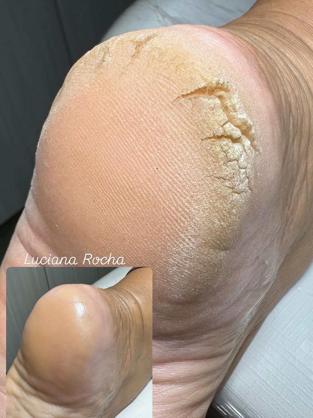 Photo by Luciana Rocha | Estética dos Pés / D’Epilação & Sobrancelhas in Studio Luciana Rocha. May be an image of text that says 'Luciana LucianaRocha Rocha'.