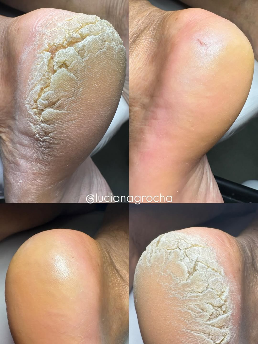 Photo by Luciana Rocha | Estética dos Pés / D’Epilação & Sobrancelhas in Studio Luciana Rocha. May be an image of text that says 'Glucianagrocha'.