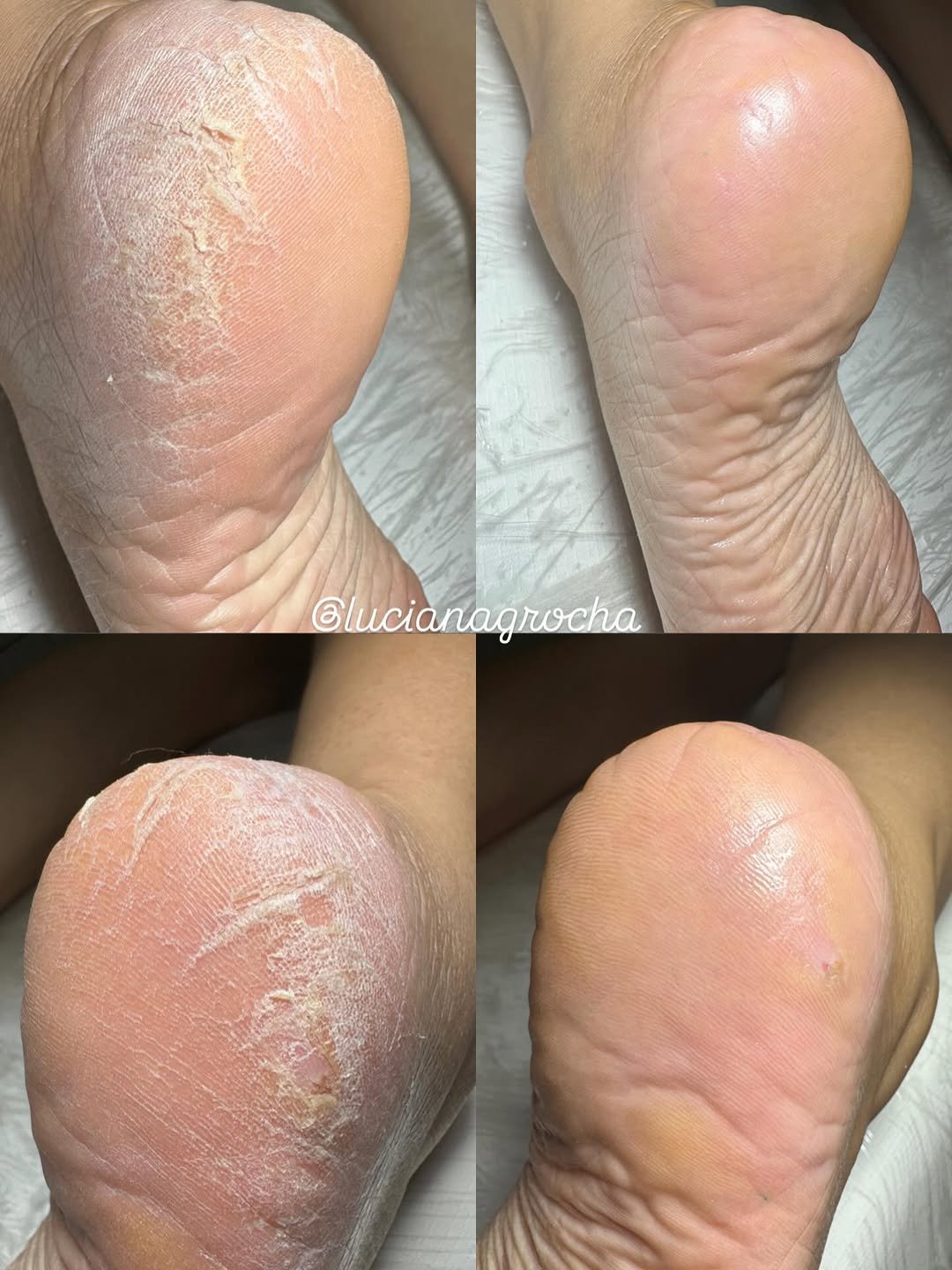 Photo by Luciana Rocha | Estética dos Pés / D’Epilação & Sobrancelhas in Cajàzeiras, Paraiba, Brazil. May be an image of one or more people, fingernails and text.