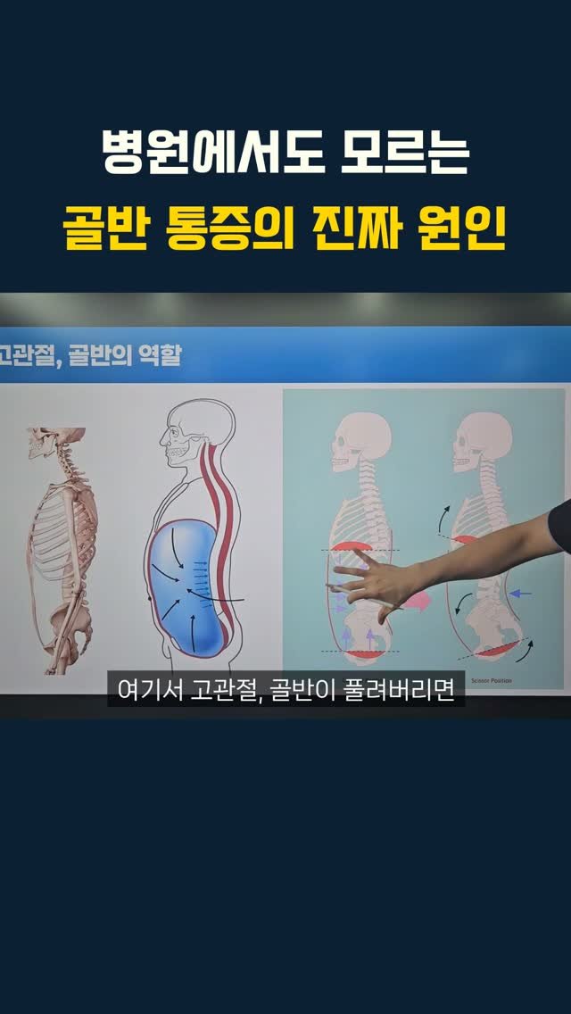 lyhscr7 게시물 이미지: 병원에서도 모르는 골반 통증의 진짜 원인