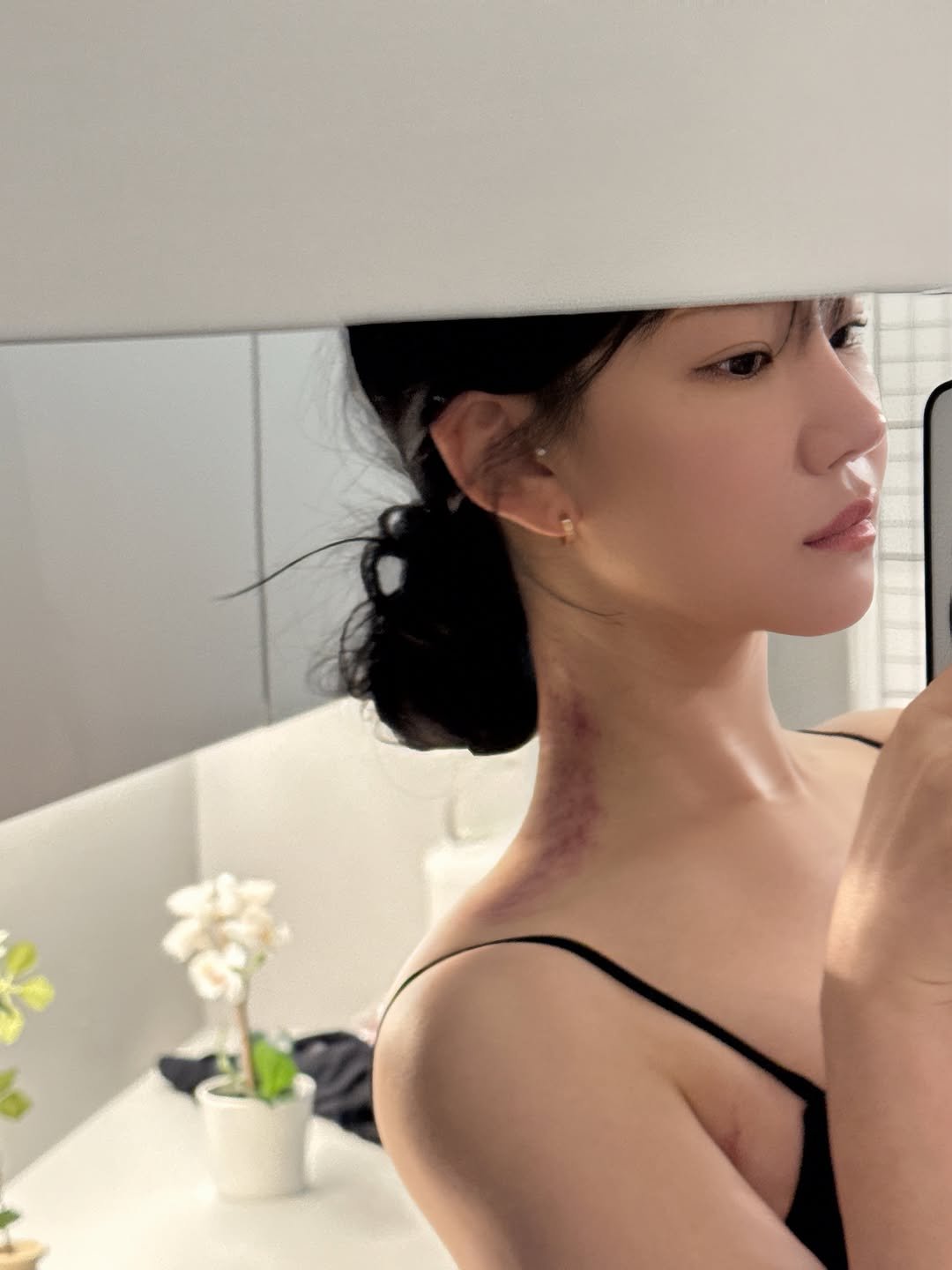 lyu_jiann 게시물 이미지: 목통증때문에 새벽에 자다가 깰 정도로 너무 안좋았는데
수기로 안풀리는 속근육까지...