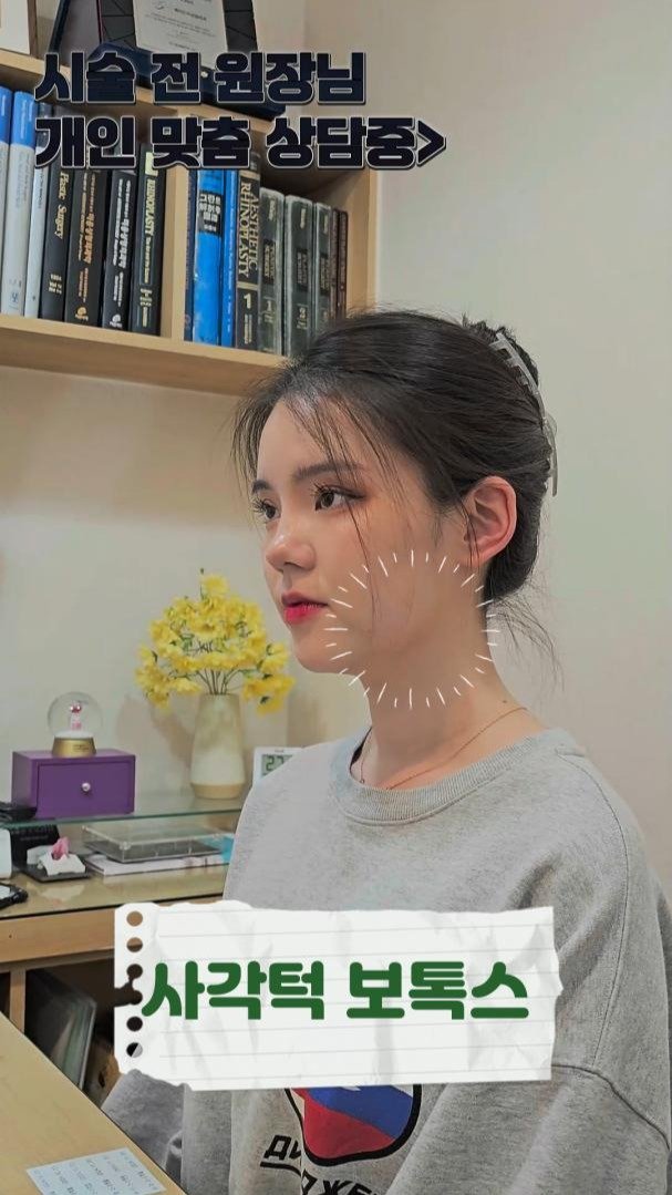 mademe_plastic_korea 게시물 이미지: 턱보톡스? 내가 아르켜줄게 #턱보톡스

오늘은 가장 많이 받으시는 시술 중 하나인...