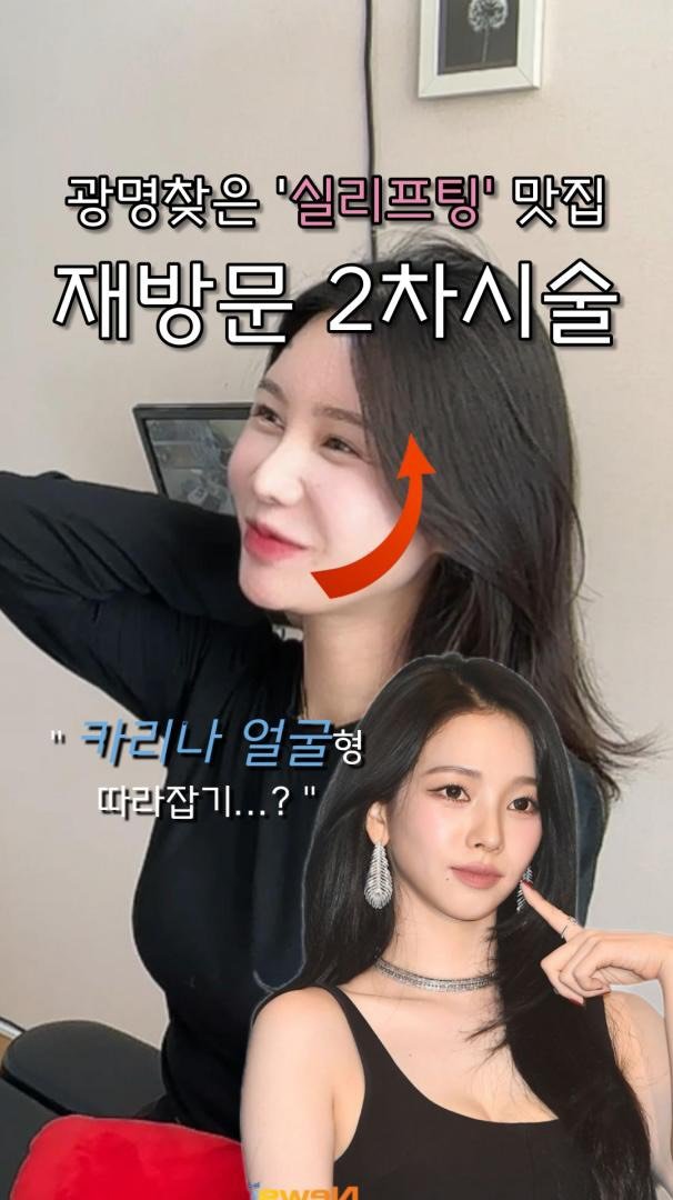 mademe_plastic_korea 게시물 이미지: 실루엣소프트 후 2차 관리! 
예뻐진김에 확실히 더 예뻐져요♡

#메이드미...