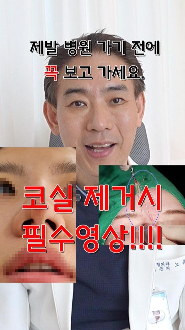 mademe_plastic_korea 게시물 이미지: 제발 코실제거 병원 가기 전에 꼭 보고 가세요.... #코실제거

#코실제거...