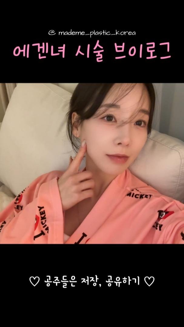 mademe_plastic_korea 게시물 이미지: 에겐녀의 시술 브이로그 #메이드미

#메이드미 #메이드미성형외과 #실리프팅 #실루엣소프트