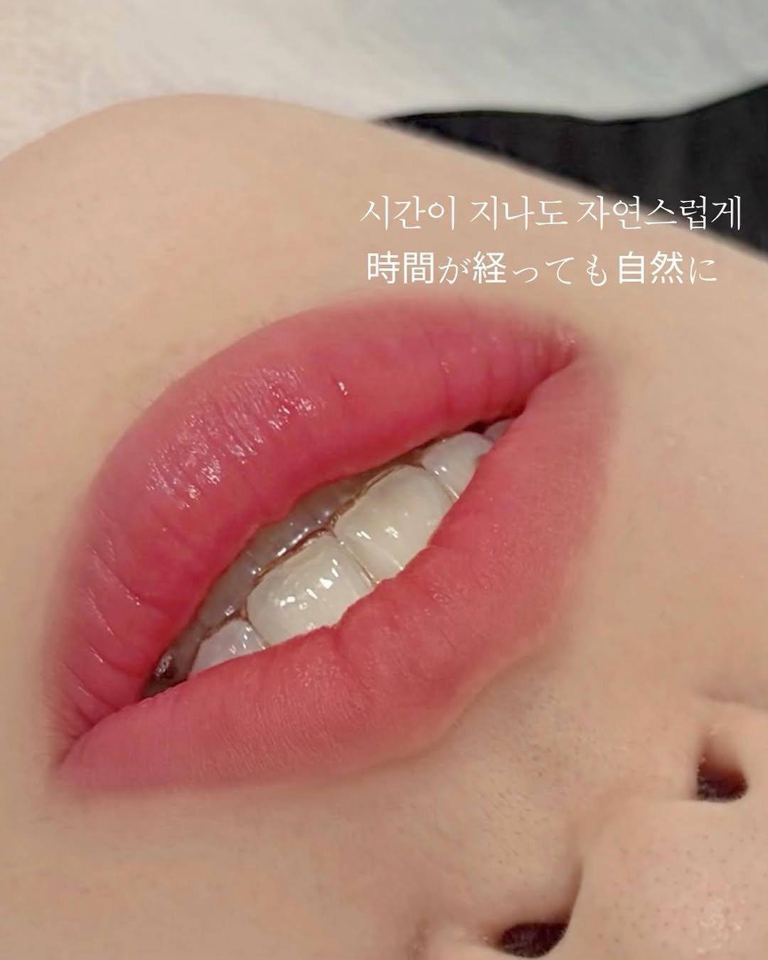 marchda_ 게시물 이미지: 물놀이 시즌, 입술도 미리 준비하시더라구요
시간이 지나도 자연스러운 혈색이 남을 수...