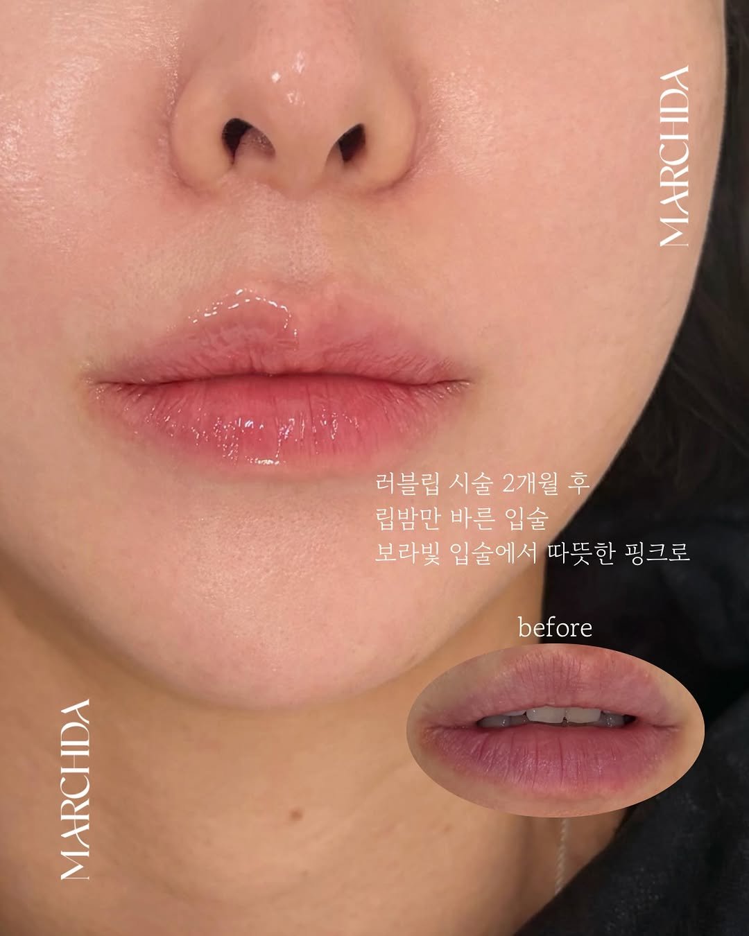 marchda_ 게시물 이미지: 차갑고 푸르게 보이던 입술도 자연스럽게 따뜻한 톤으로 정리해주는 것만으로, 평소...