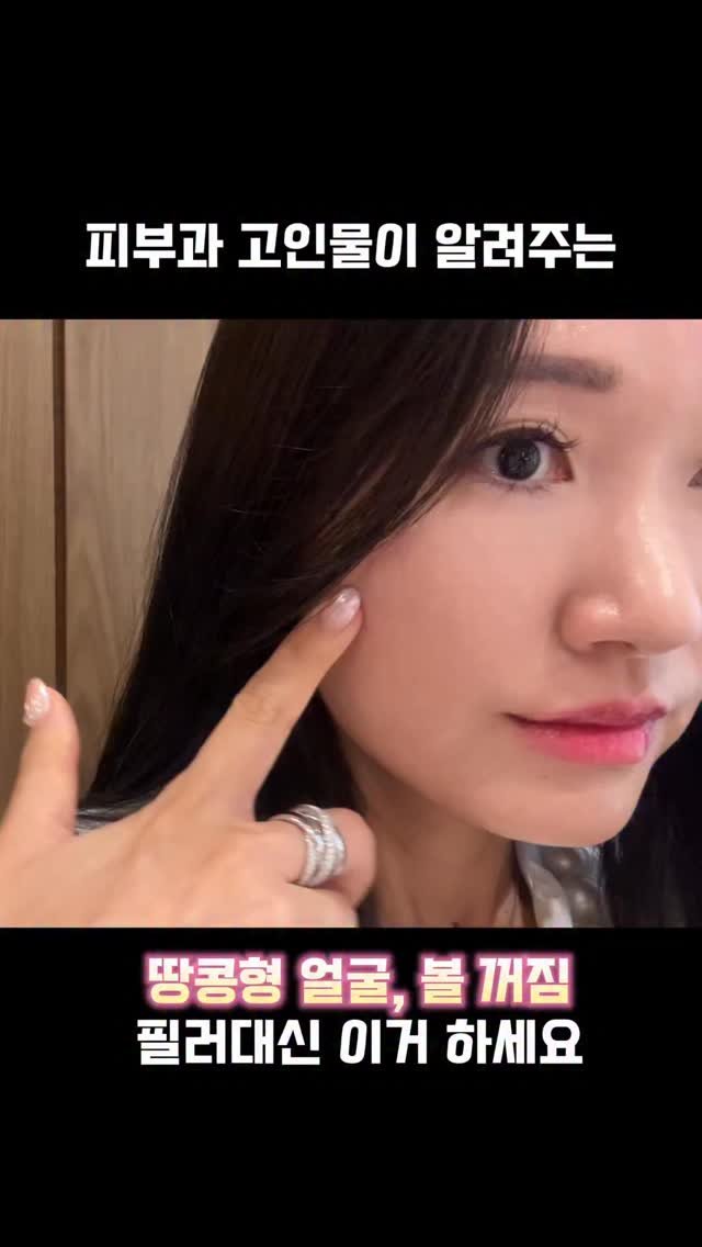 mari_stellaaaaa 게시물 이미지: 땅콩형 얼굴라인과 볼륨없는 얼굴이
늘 고민이었는데 리프팅 시술로는
채워주지 못하는...