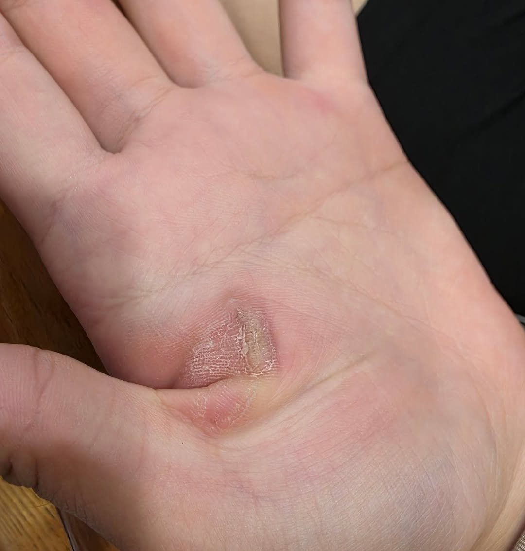 Photo by 소사장소피아 (박혜정) on August 27, 2025. May be an image of bandage.