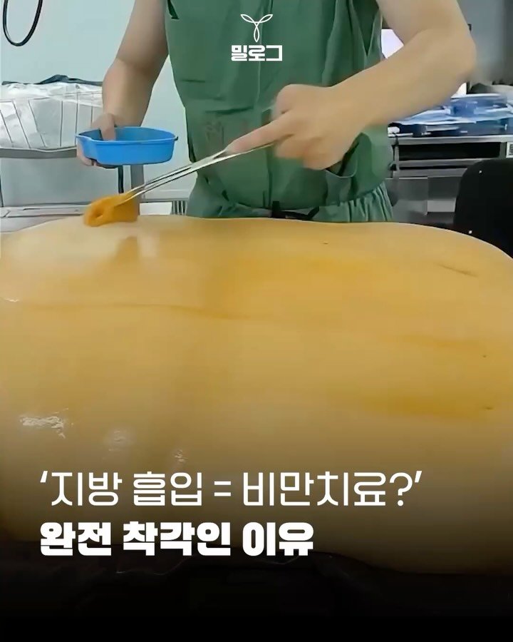 meal.log__ 게시물 이미지: 💉 지방 흡입을 해도 비만이 해결되지 않는 이유

1️⃣ 우리 몸의 지방은 다 같은...