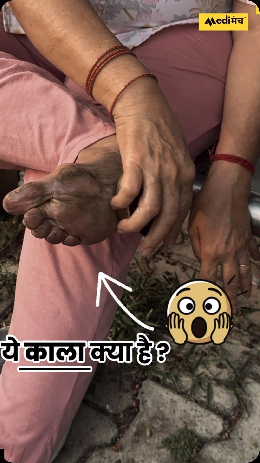 medimanch 게시물 이미지: कटोरी रगड़ते ही शरीर के अंदर की गंदगी कालक...