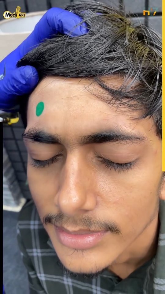 medimanch 게시물 이미지: 👇इस पॉइंट को दबाओ और देखो कमाल! 😱 #viral...