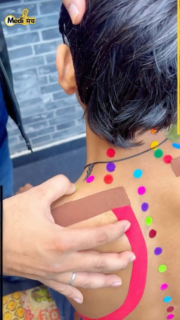 medimanch 게시물 이미지: जाम कंधा खुलेगा तुरंत ऐसे Mayank Porwal #trending