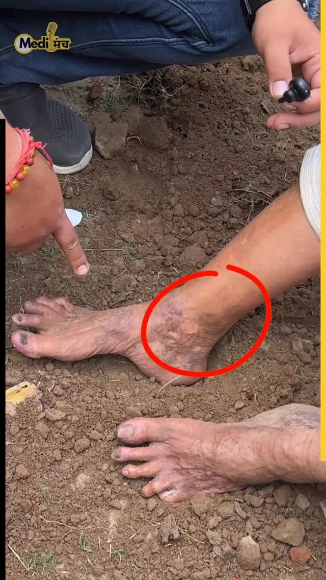 medimanch 게시물 이미지: कमाल के फायदे देती है 20 मिनट ये कर लिए तो Dr....