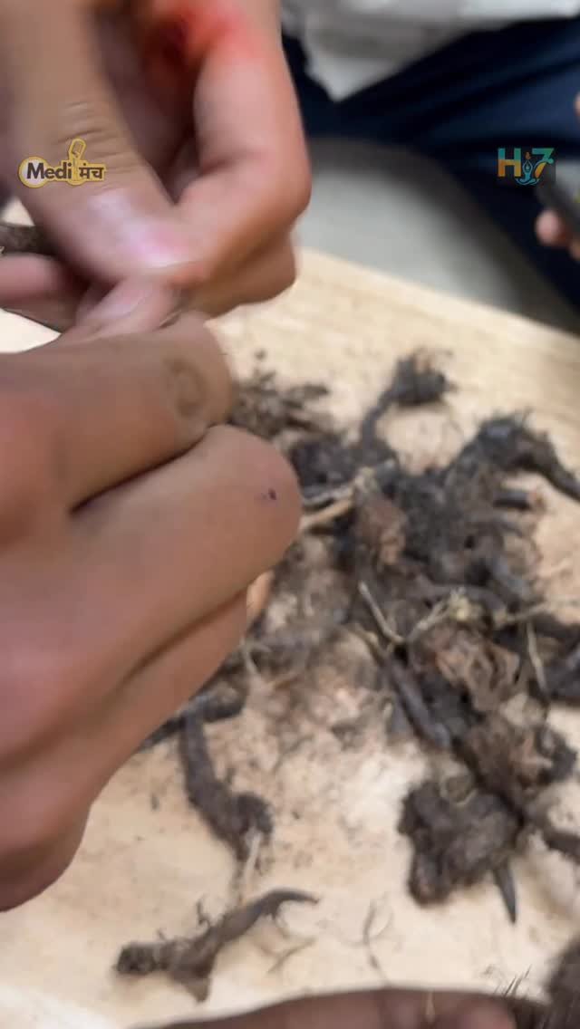 medimanch 게시물 이미지: ये जड़ जहाँ दिखे तोड़ लेना होंगे चौंकानेवाले...