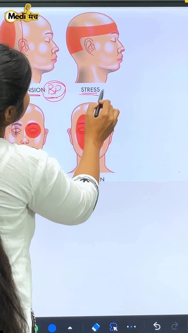 medimanch 게시물 이미지: माइग्रेन के लिए सबसे अच्छा है ये फल #pain...