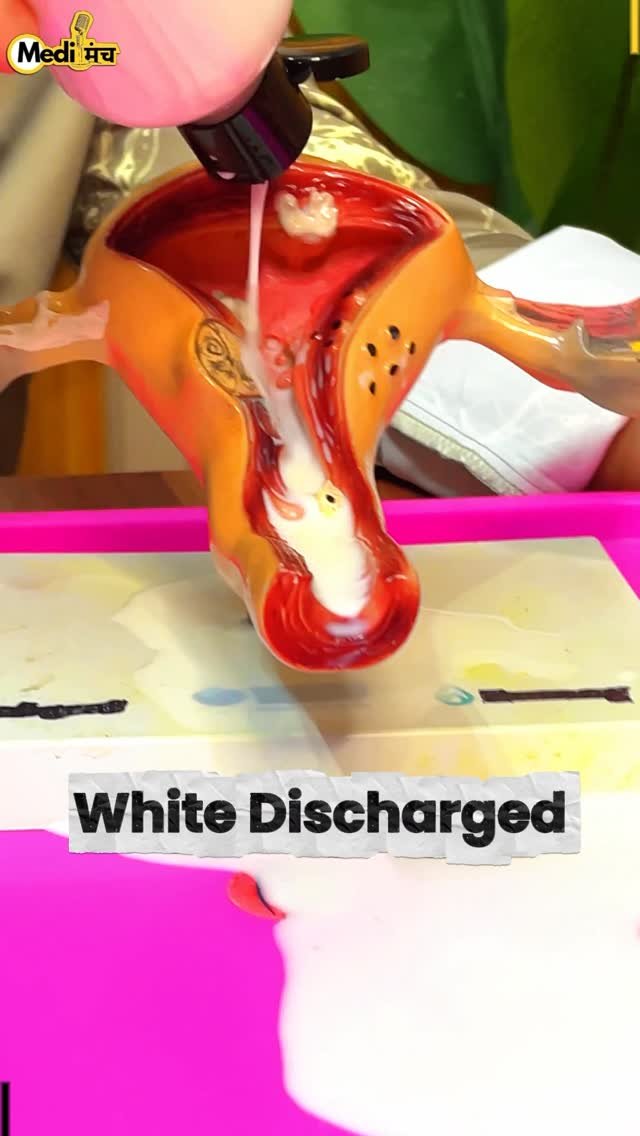 medimanch 게시물 이미지: पेट की हर बीमारी में गीली पट्टी कैसे काम करती...