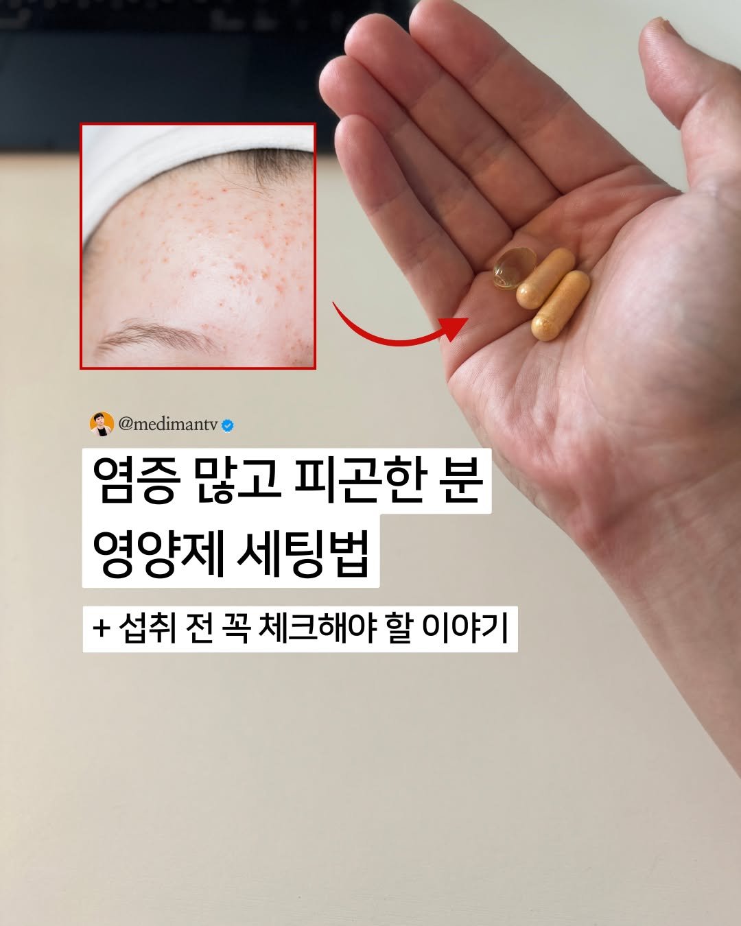 Photo by 약사 메디슨맨 | 장무현 on December 21, 2025. May be an image of medicine and text that says '@medimantv 염증 많고 피곤한 분 영양제 세팅법 + 섭취 전 꼭 체크해야 할 이야기'.