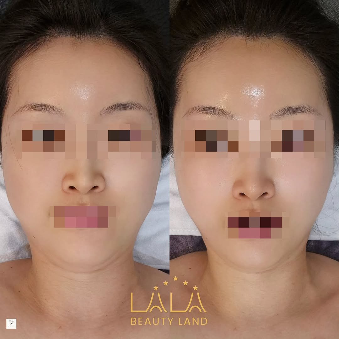 meebbeunada 게시물 이미지: 산후3개월차!

크레이지 하시길 참 잘했죠 ~~ 😆❤️
이래서 제가 크레이지 찬양을...