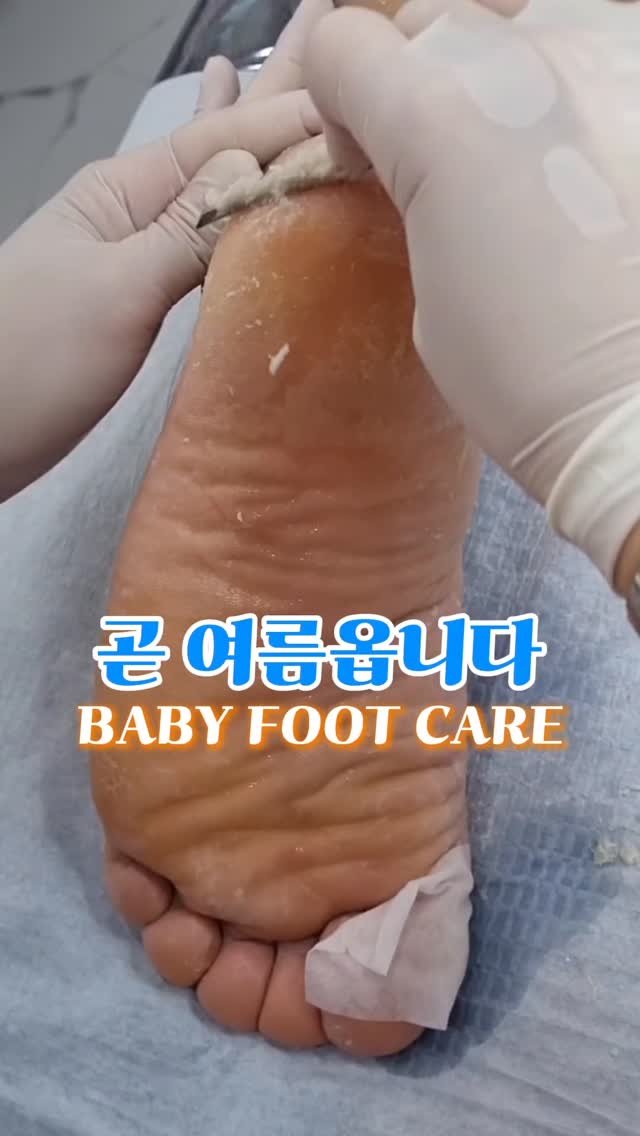 meebbeunada 게시물 이미지: 중독영상 🤭

요 중독영상은 오랜만이죠 🥹
언제나 열심히 각질 밀어드리구있어요!...