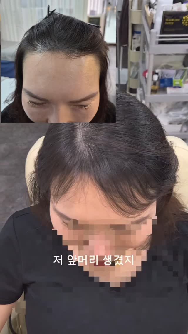 meebbeunada 게시물 이미지: 앞머리 만들어드립니다 ❣️

점점 넓어지는 이마가 걱정스러워
괜한 샴푸들만 이것...