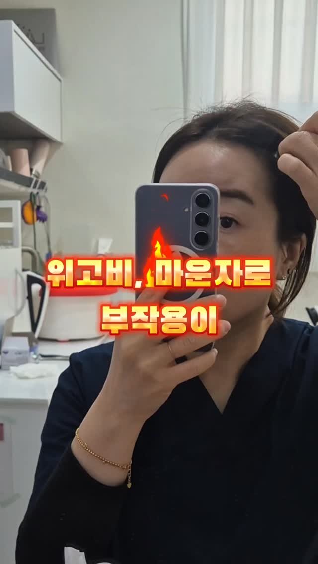 meebbeunada 게시물 이미지: 위고비, 마운자로 하실 분들 주목! 🫡

위고비, 마운자로 주의사항에 
탈모에...
