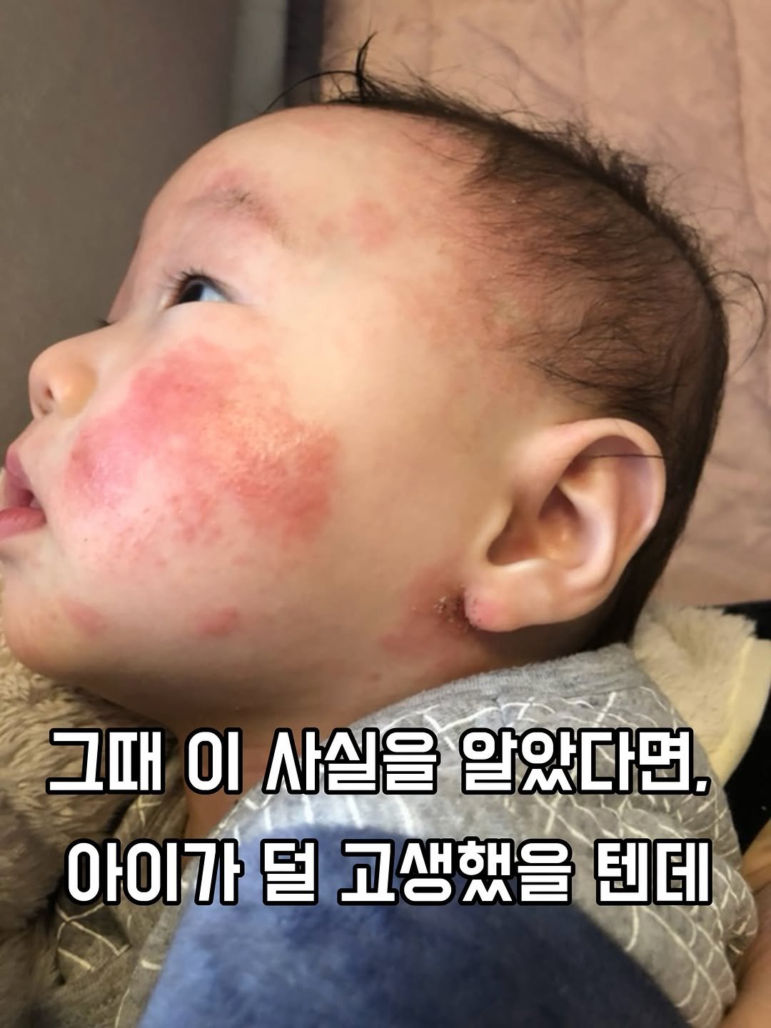 merci_la_foret 게시물 이미지: #공구예고 #기대평이벤트 저희 큰애도 심한 아*피로 몇 년을 고생했어요.
지금은...