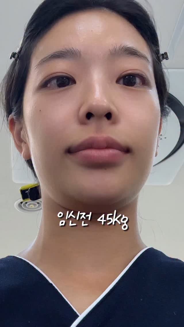 milk._.couple 게시물 이미지: 임신하고 15kg찐 사람의 비포에푸터..
#임신체중 #임신브이로그 #임신27주차