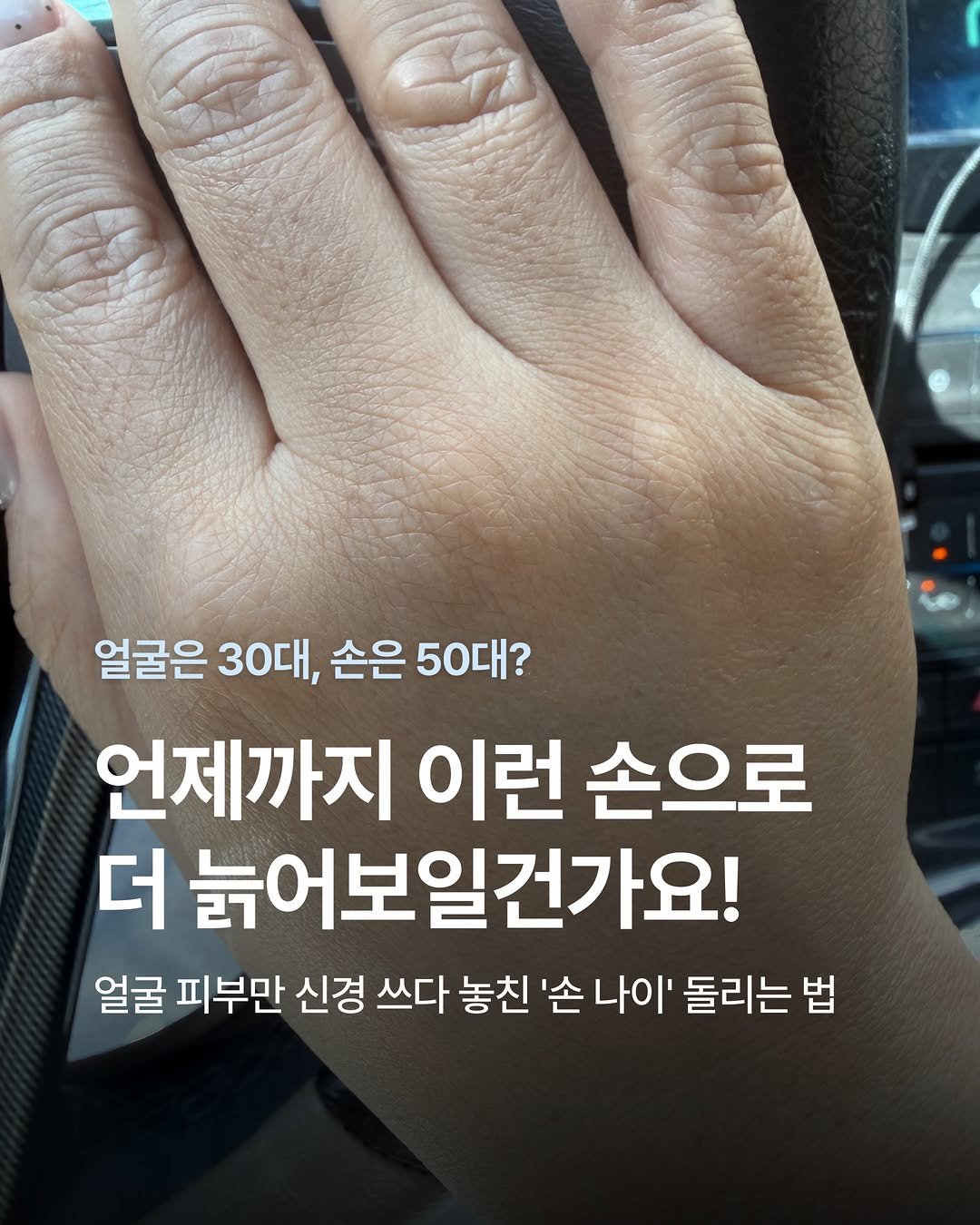 mimoade_ 게시물 이미지: 여자의 나이는 얼굴이 아니라 손과 목에서 완성됩니다.
얼굴 시술에는 선뜻 수십,...