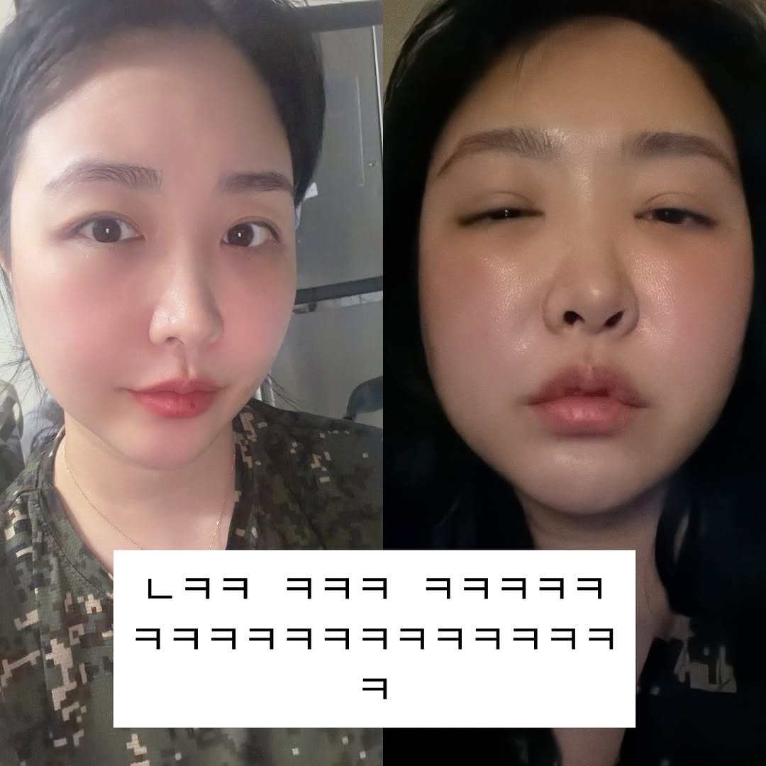 mimoade_ 게시물 이미지: 및ㅊㅊ친 웃기다 
웃겨서 올림 
눈밑지 한지 이제 2주차 인데요 
처음부터 그냥...