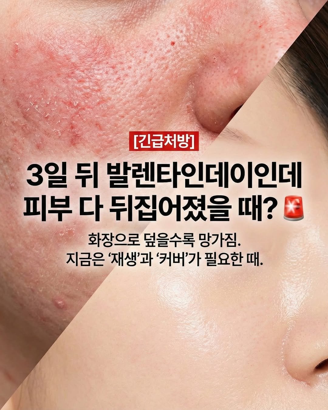 Photo by 미남마켓 on February 11, 2026. May be an image of text that says '[긴급처방] 3일 뒤 발렌타인데이인데 피부 다 뒤집어졌을 때? 화장으로 덮을수록 망가짐. 지금은 '재생'과 '커버'가 필요한 때.'.