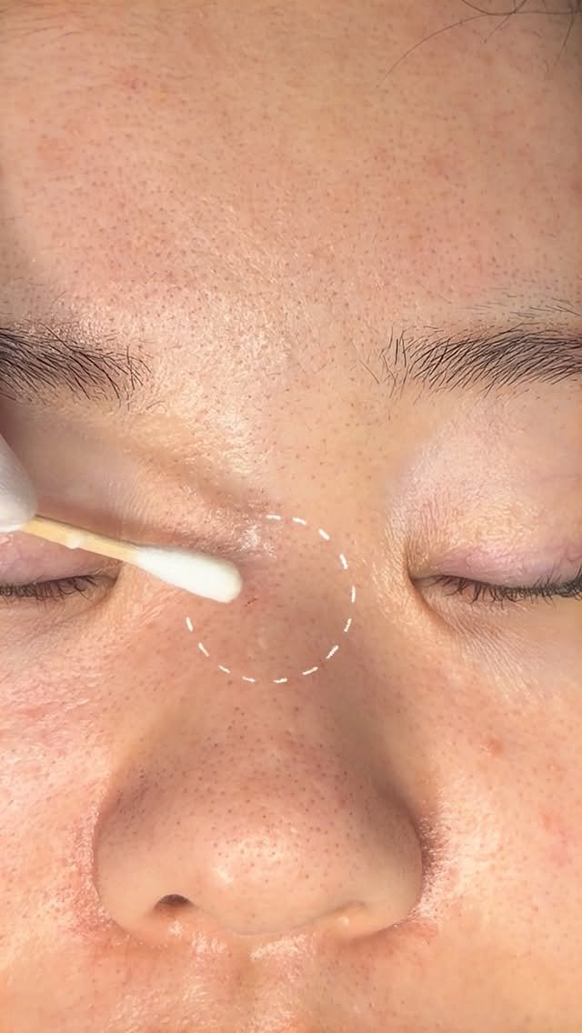 minbeauty_s2 게시물 이미지: 코코리젠  본사입니다  색소케어 코코리젠 수강/관리 가능합니다.
멜라닌 케어 전문...