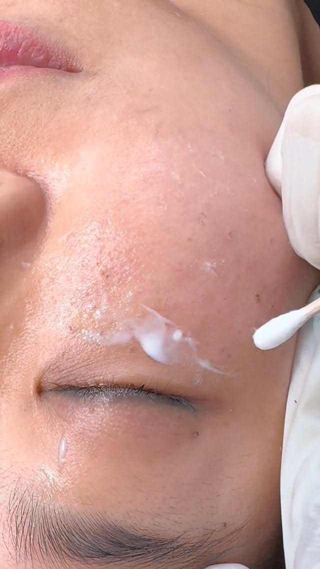 minbeauty_s2 게시물 이미지: 매출상승 보장 진짜 치키트 시술✔️
코코리젠 수강료270 /  원데이수강
코코리젠...