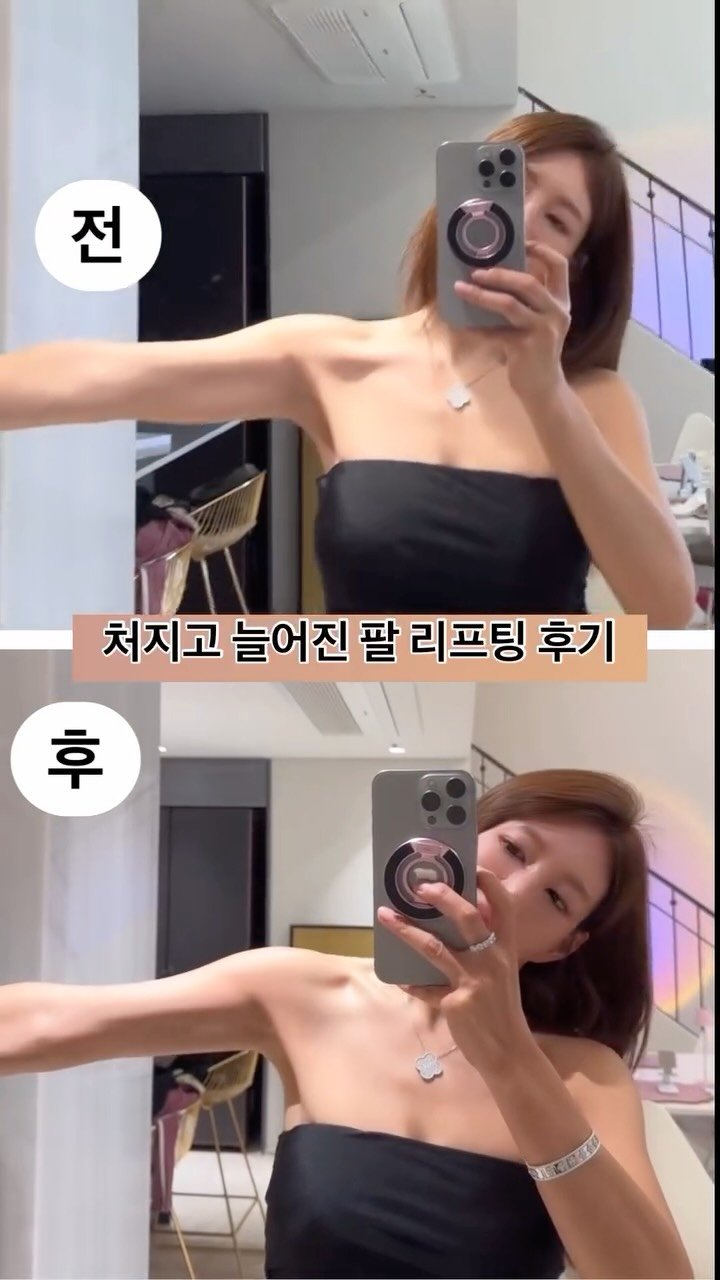 minimiel_46 게시물 이미지: 꾸준히 운동하면 탄력이 생기지만. . .
몇개월 방심하고 소홀했더니
탄력이 급격히...