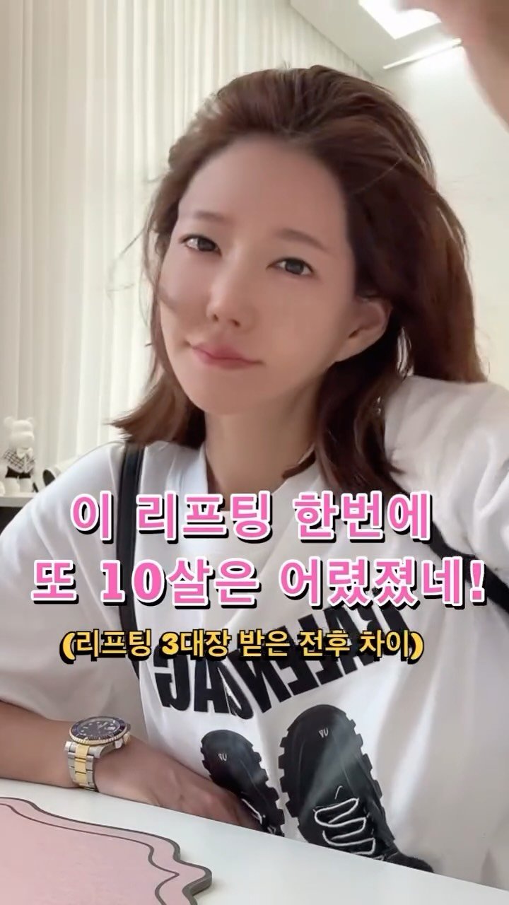 minimiel_46 게시물 이미지: 울쎄라 프라임 이런분들이 받으면 좋아요 ^^

•	턱선·이중턱 정리 →...