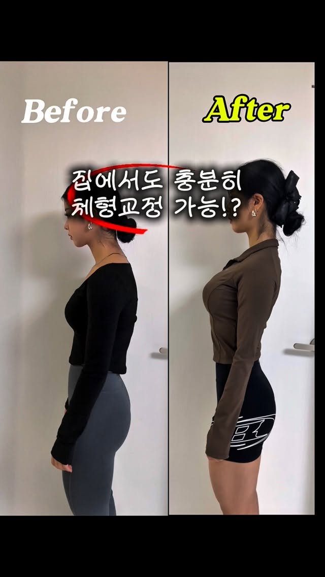 minlee0880 게시물 이미지: 내가 일자목,라운드숄더였다뉘😱
요즘 목이랑 어깨가 계속 뻐근해서
체형 교정을 받구...