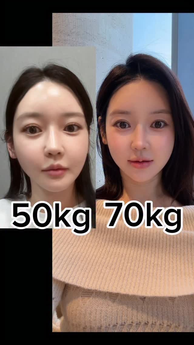 minsshop_jm 게시물 이미지: 50kg 부은 내 얼굴 
솔직히 70kg인 지금보다 더 살쪄보이지 않나요?...