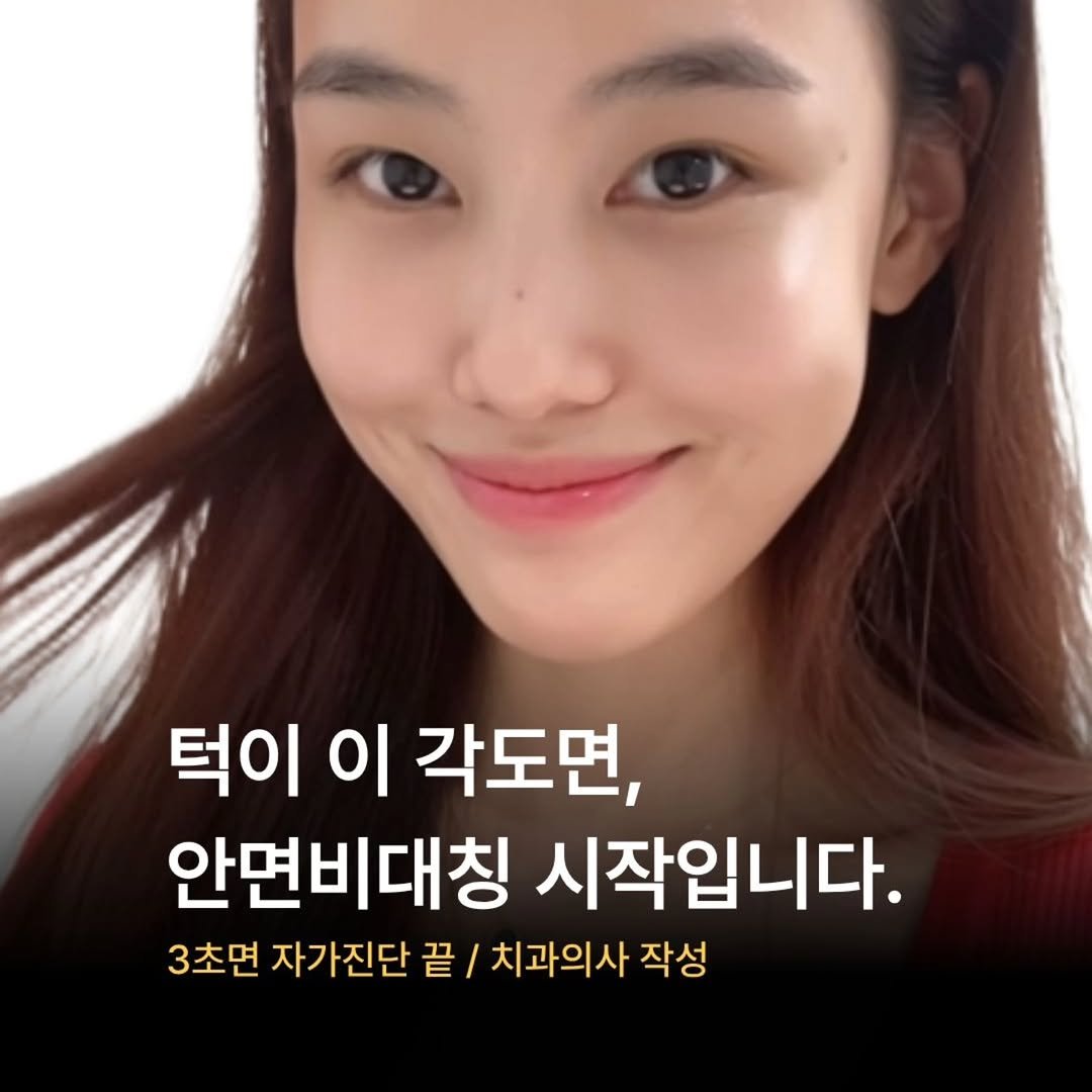 miso5652812 게시물 이미지: 사진 찍을 때마다
턱이 한쪽으로 밀려 보인다면
안면비대칭 이미 시작됐을 수...