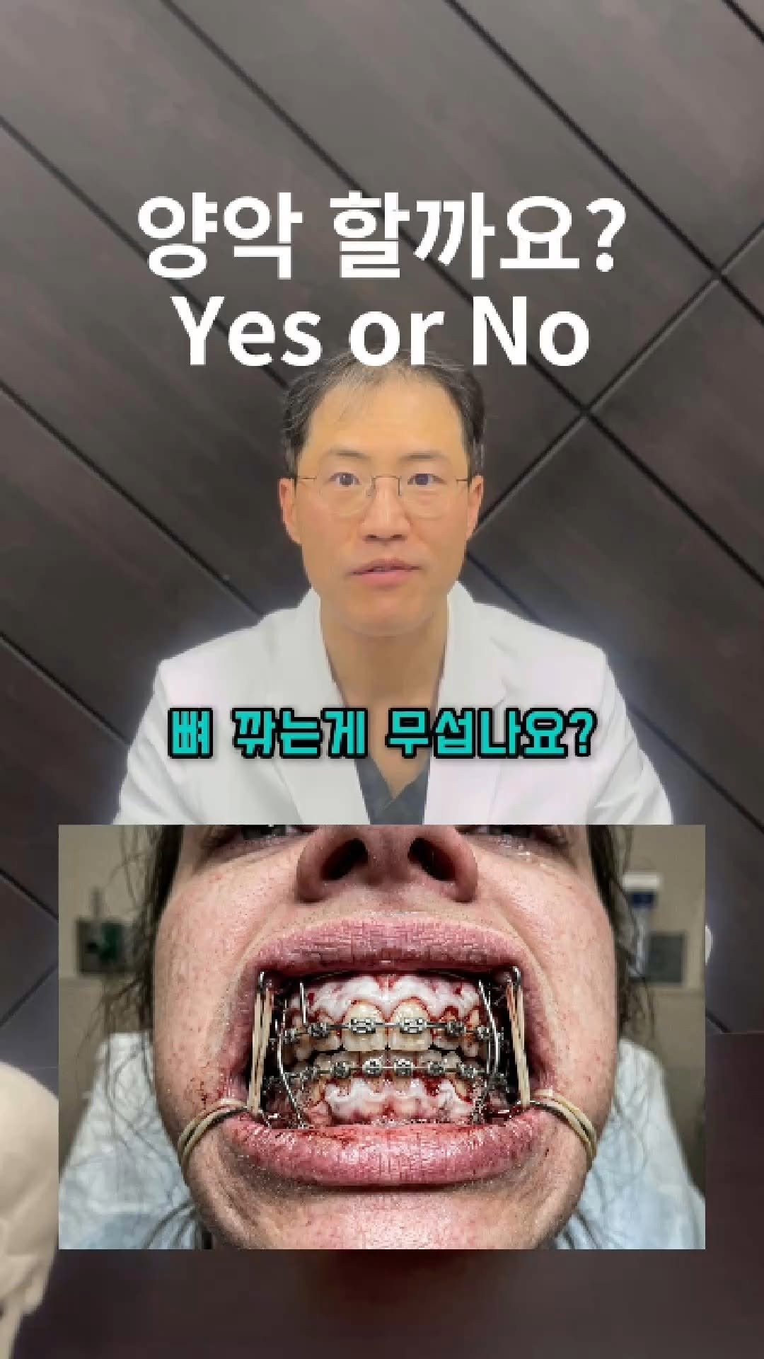 miso5652812 게시물 이미지: 이런 경우, 수술 없이 교정을 통해 교합을 재설계하는 것만으로도 턱의 위치를...