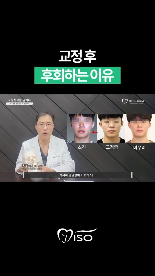 miso5652812 게시물 이미지: "뼈가 튀어나온 주걱턱, 무조건 수술이 정답일까요?"
주걱턱 진단을 받았다고 해서...