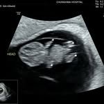 gim.snake 프로필 사진