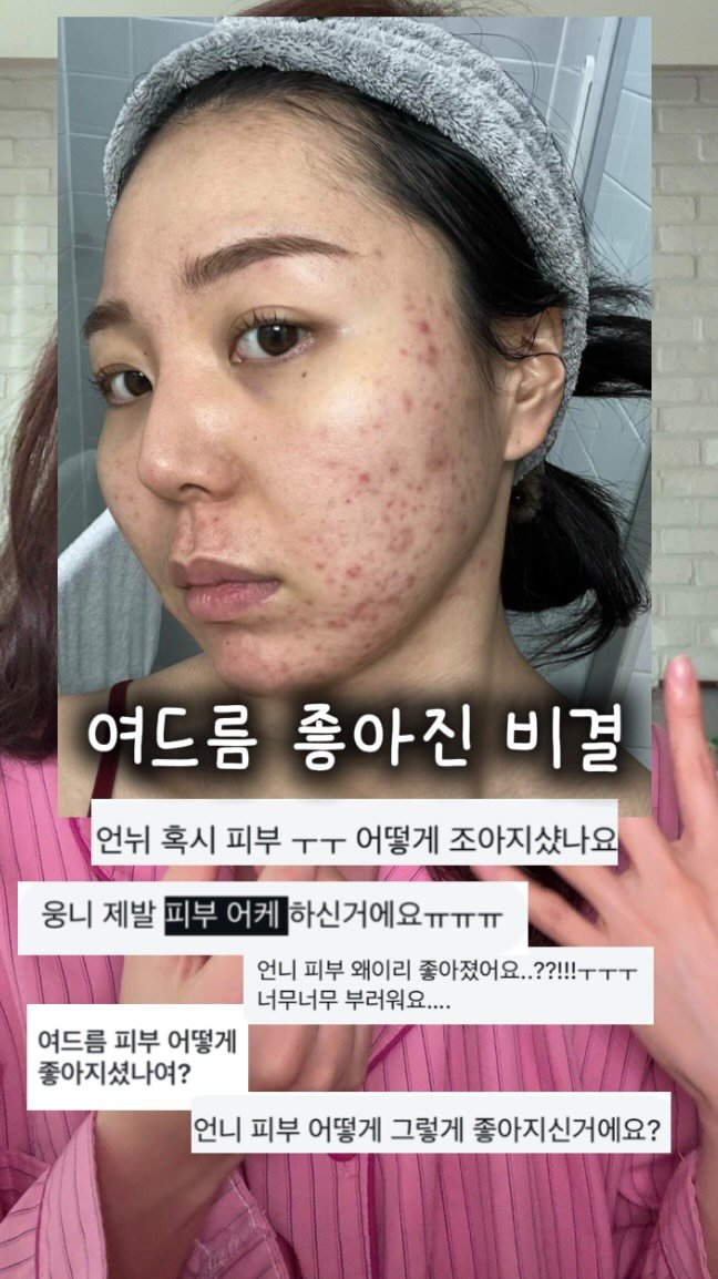 morinyeo 게시물 이미지: #오픈 저의 구원템,, 여드름 앰플 할인이 3개월만에 돌아왔습니다💌

최근 더...