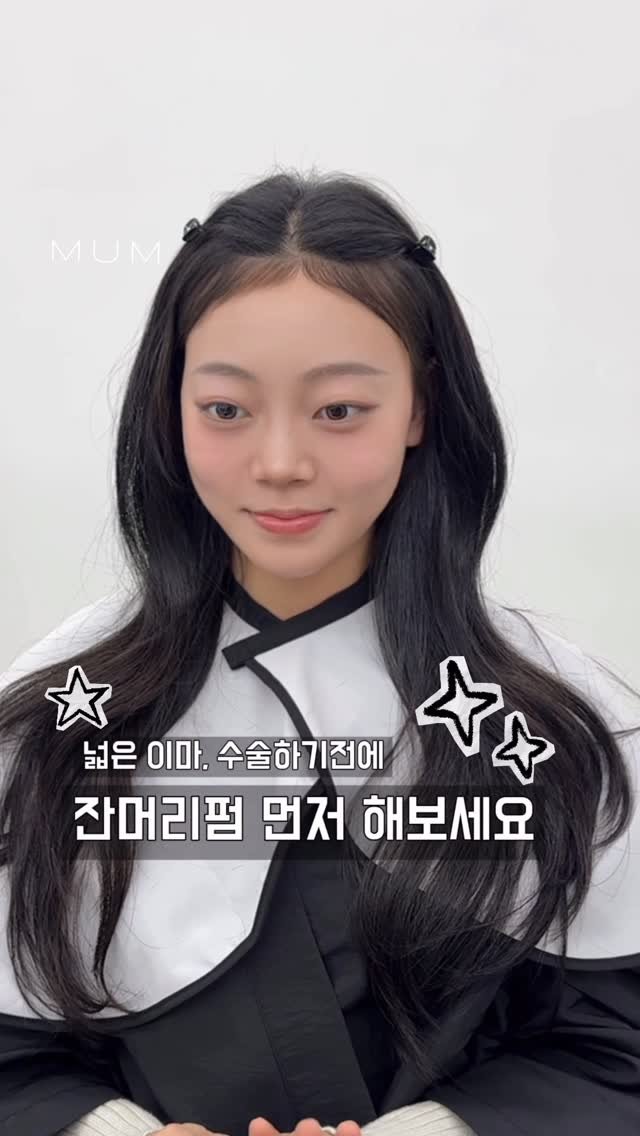 mum_iam.zzung 게시물 이미지: 넓은 이마, 수술이 답이다 ? NO 
잔머리펌 먼저 해보고 나서 생각해보세요...