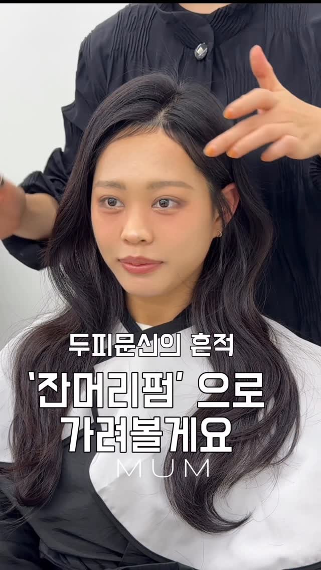 mum_iam.zzung 게시물 이미지: 두피문신의 흔적 , 잔머리펌으로 가려볼게요 
남색, 또는 붉은색으로 남겨진...